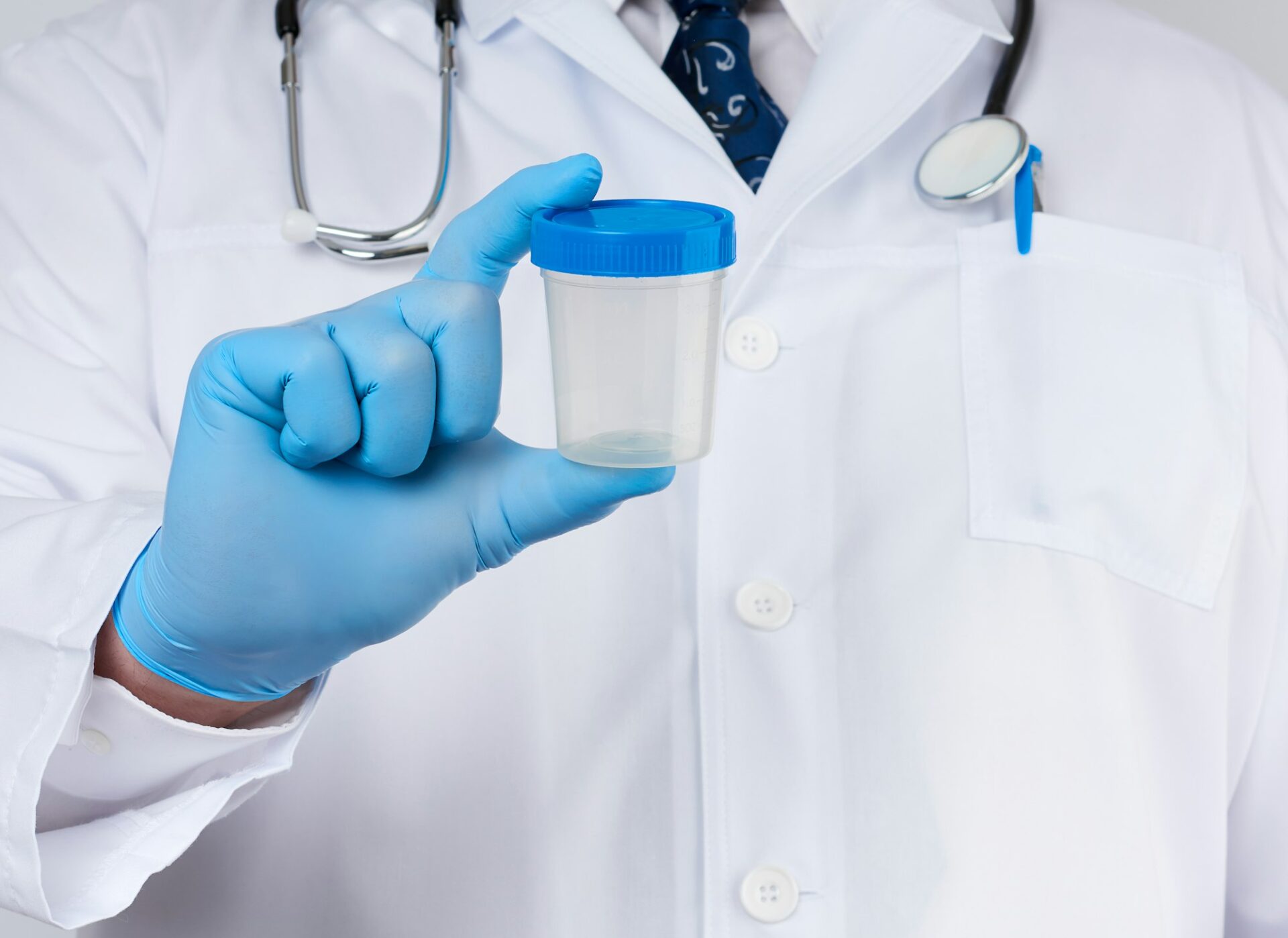 Male doctor in a white coat and tie stands and holds a plastic container for urine specimen